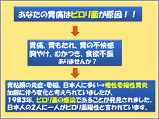 あなたの胃痛はピロリ菌が原因